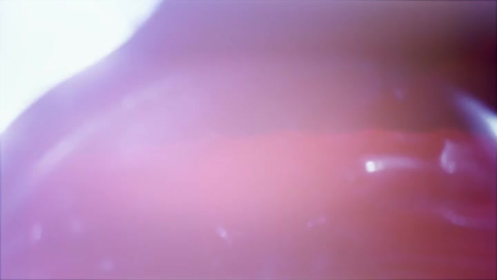 Light Leaks Element 234