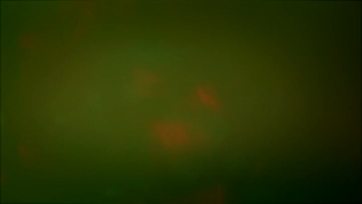 Light Leaks Element 266