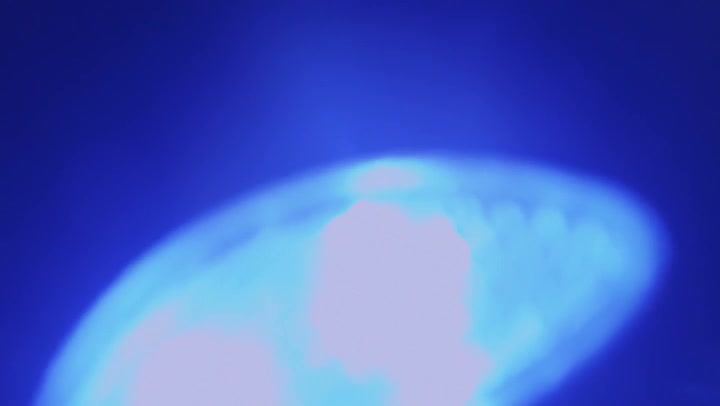 Light Leaks Element 462